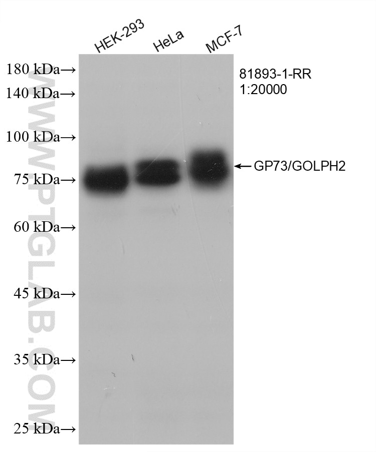 Western Blot (WB) analysis of various lysates using GP73/GOLPH2 Recombinant antibody (81893-1-RR)