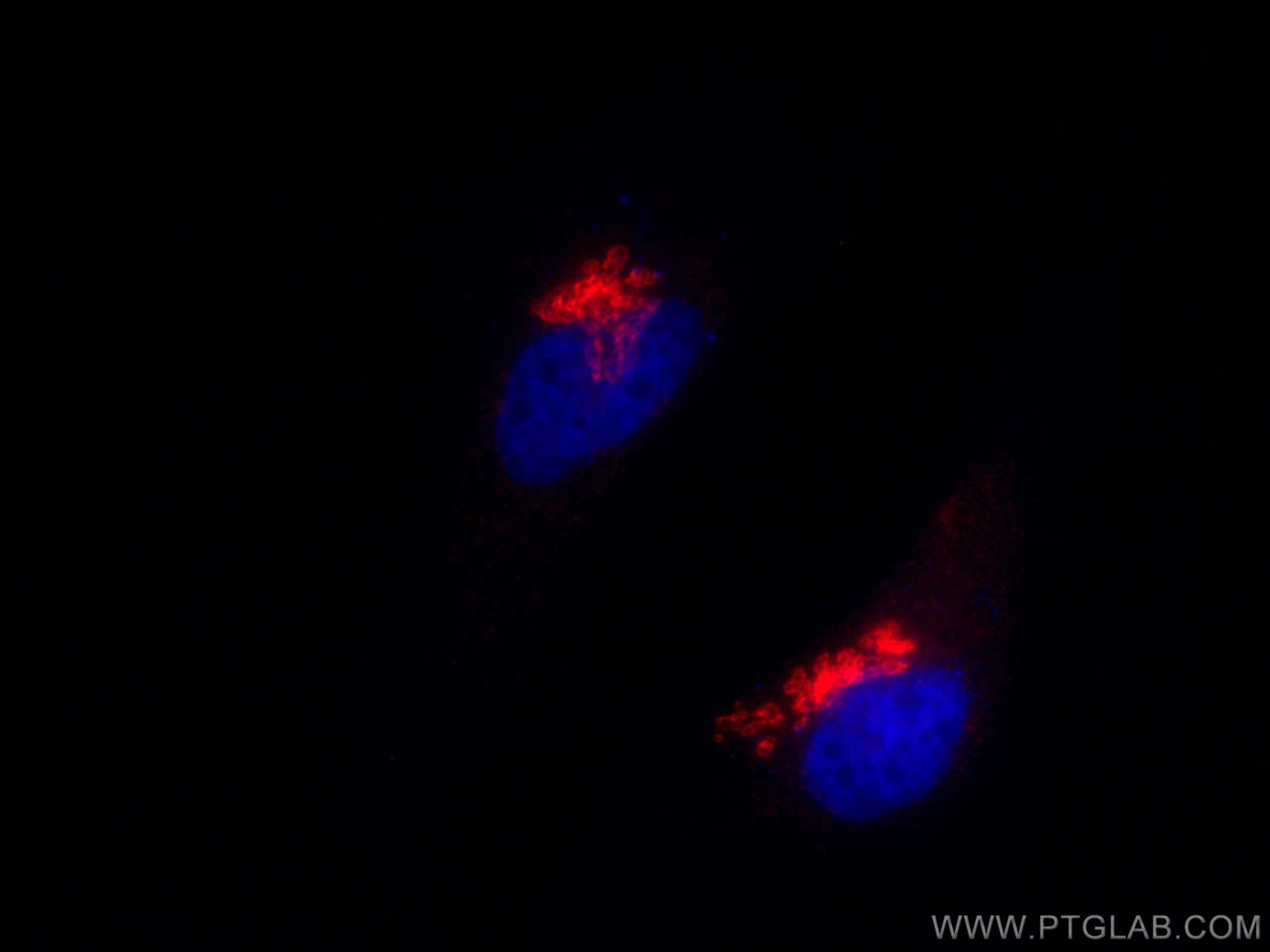 Immunofluorescence (IF) / fluorescent staining of HeLa cells using CoraLite®594-conjugated GP73/GOLPH2 Monoclonal ant (CL594-66331)