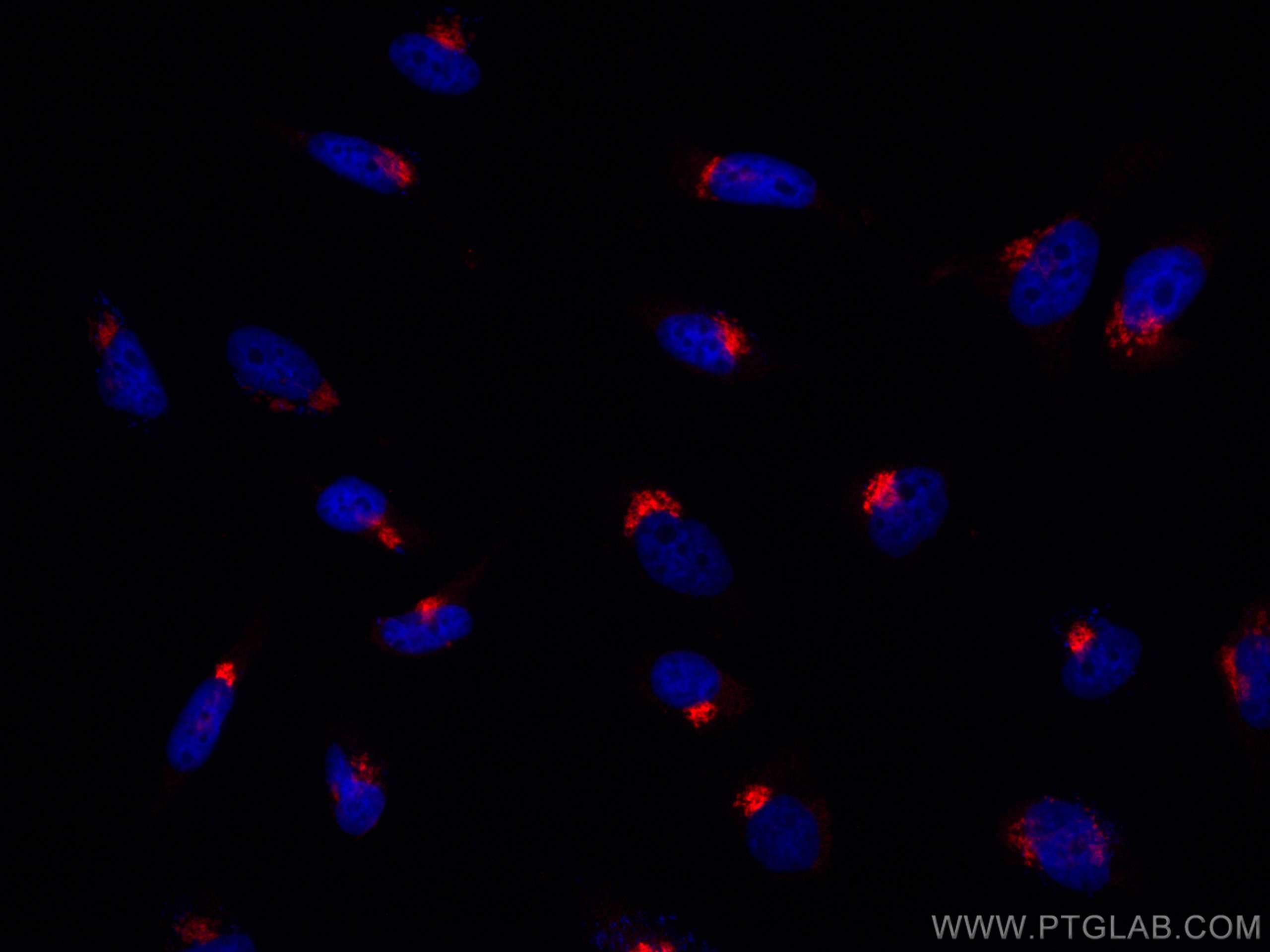 Immunofluorescence (IF) / fluorescent staining of HeLa cells using CoraLite®594-conjugated GP73/GOLPH2 Monoclonal ant (CL594-66331)