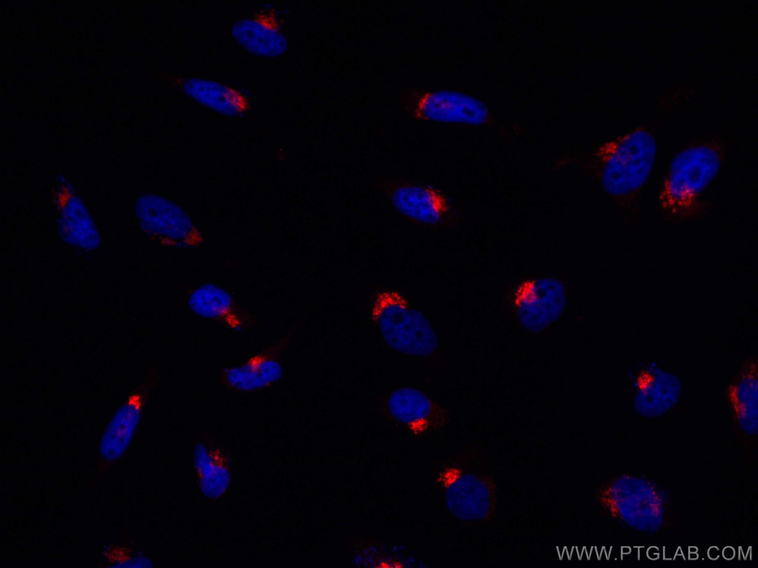 Immunofluorescence (IF) / fluorescent staining of HeLa cells using CoraLite®594-conjugated GP73/GOLPH2 Monoclonal ant (CL594-66331)