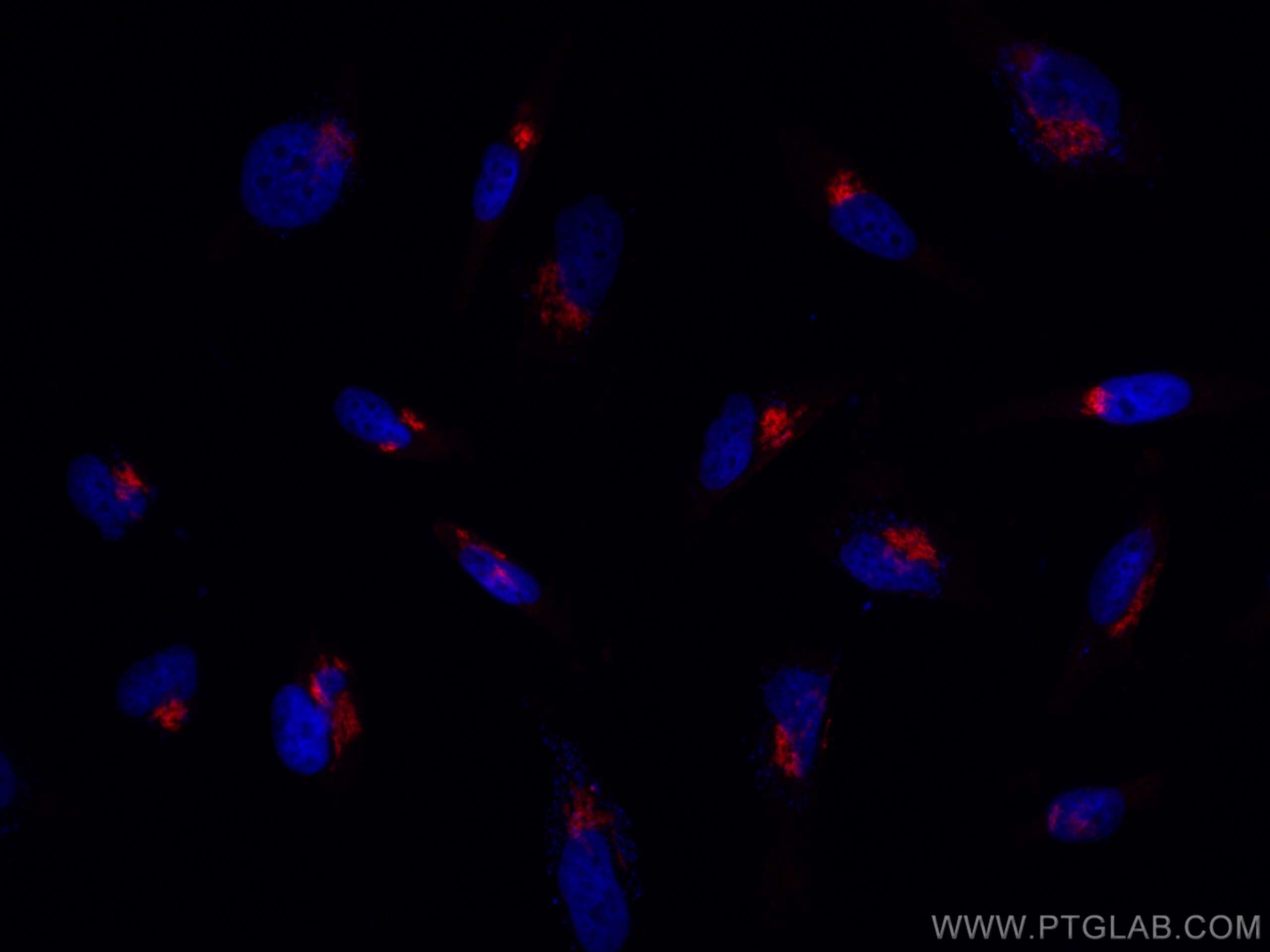 Immunofluorescence (IF) / fluorescent staining of HeLa cells using CoraLite®594-conjugated GP73/GOLPH2 Monoclonal ant (CL594-66331)