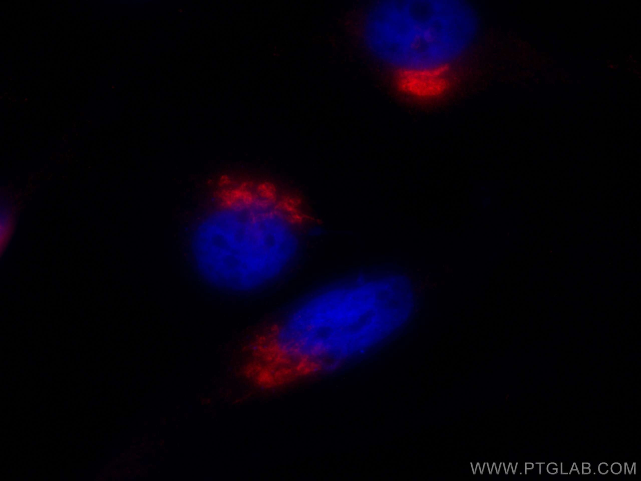 Immunofluorescence (IF) / fluorescent staining of HeLa cells using CoraLite®594-conjugated GP73/GOLPH2 Monoclonal ant (CL594-66331)