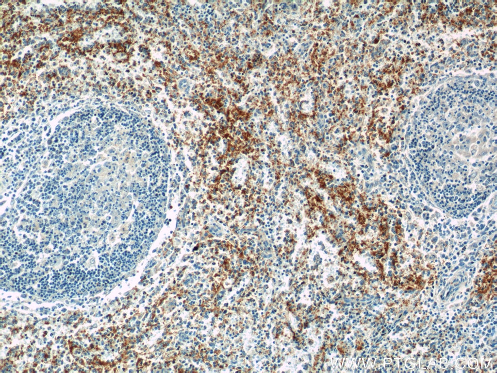 Immunohistochemistry (IHC) staining of human spleen tissue using CD42a / GP9 Polyclonal antibody (14564-1-AP)