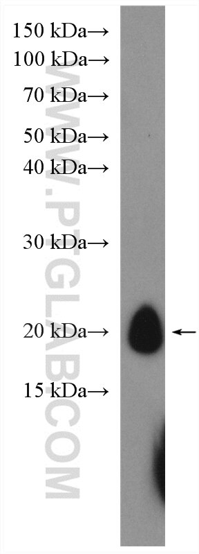 Western Blot (WB) analysis of human peripheral blood platelets using CD42a / GP9 Polyclonal antibody (14564-1-AP)