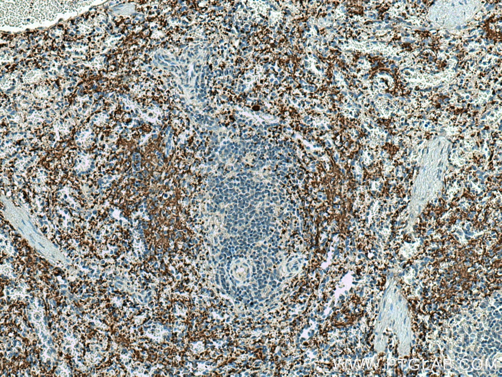 Immunohistochemistry (IHC) staining of human spleen tissue using CD42a / GP9 Monoclonal antibody (67271-1-Ig)
