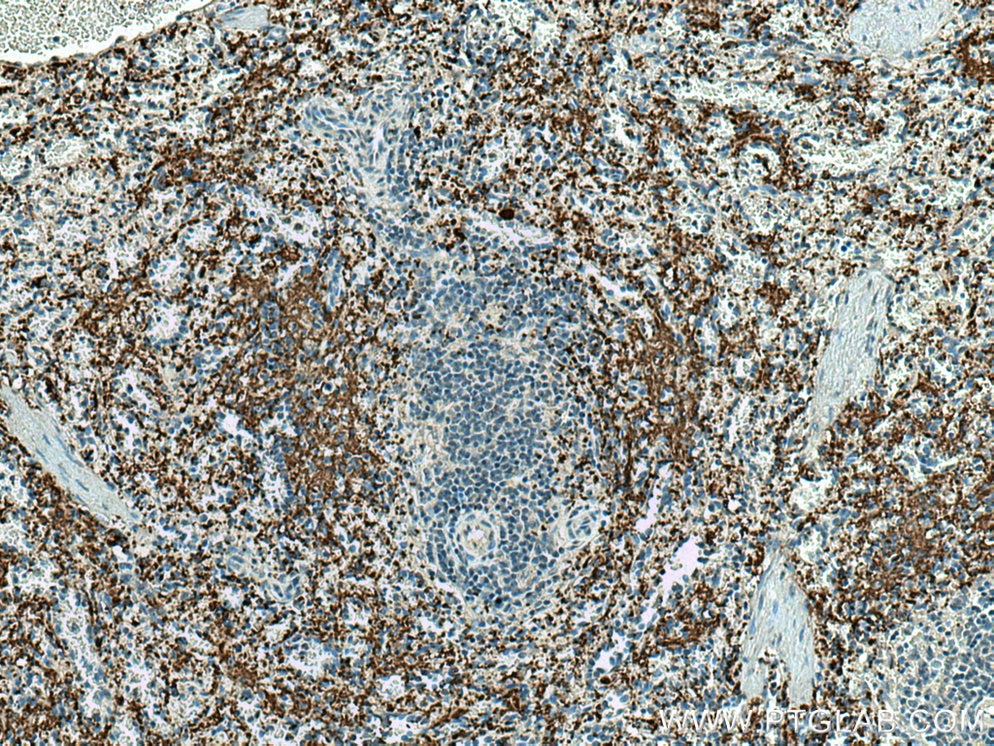 IHC staining of human spleen using 67271-1-Ig