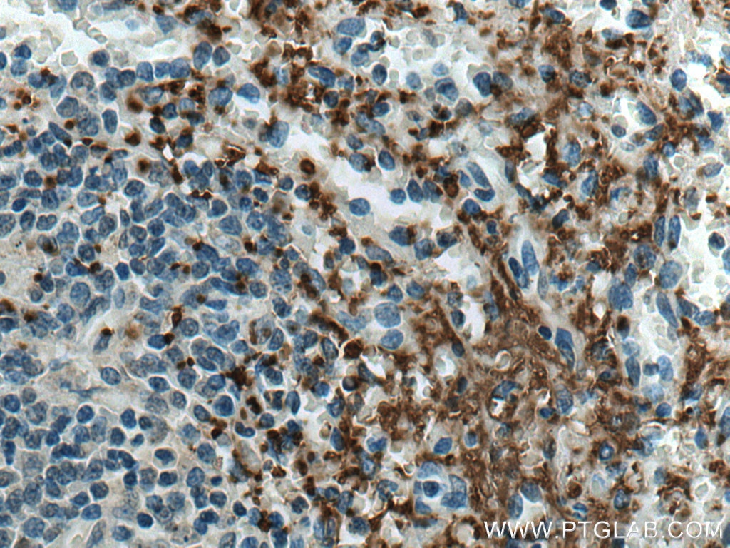 IHC staining of human spleen using 67271-1-Ig