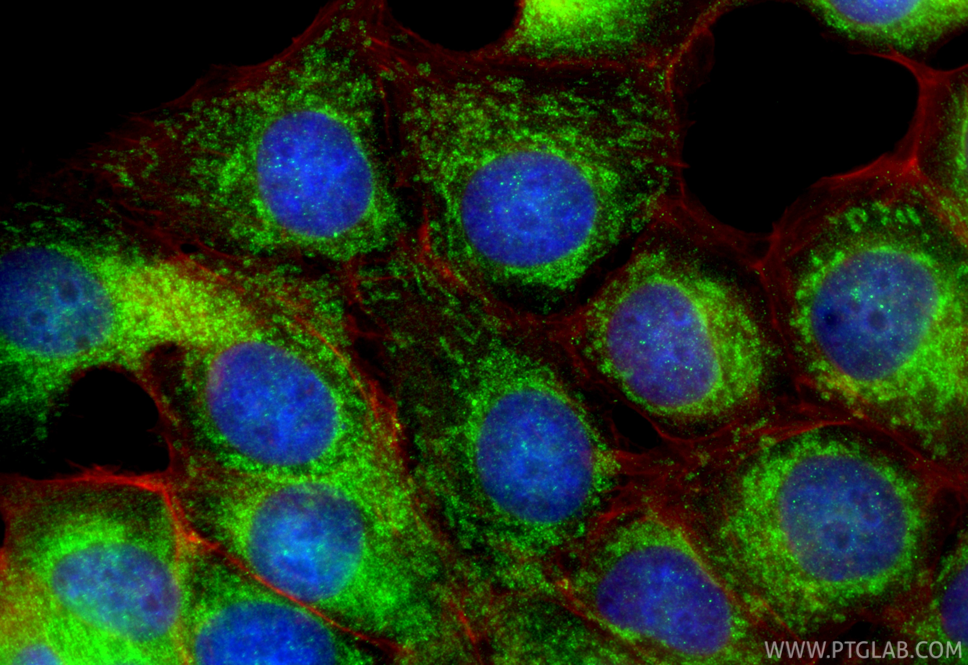 Immunofluorescence (IF) / fluorescent staining of MCF-7 cells using GPAM Polyclonal antibody (12454-1-AP)
