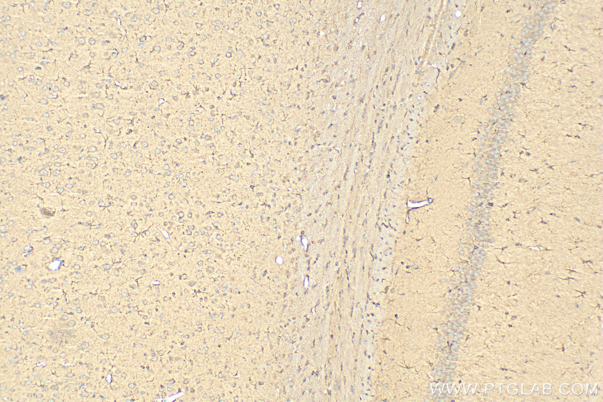 Immunohistochemistry (IHC) staining of rat brain tissue using GPAM Polyclonal antibody (12454-1-AP)
