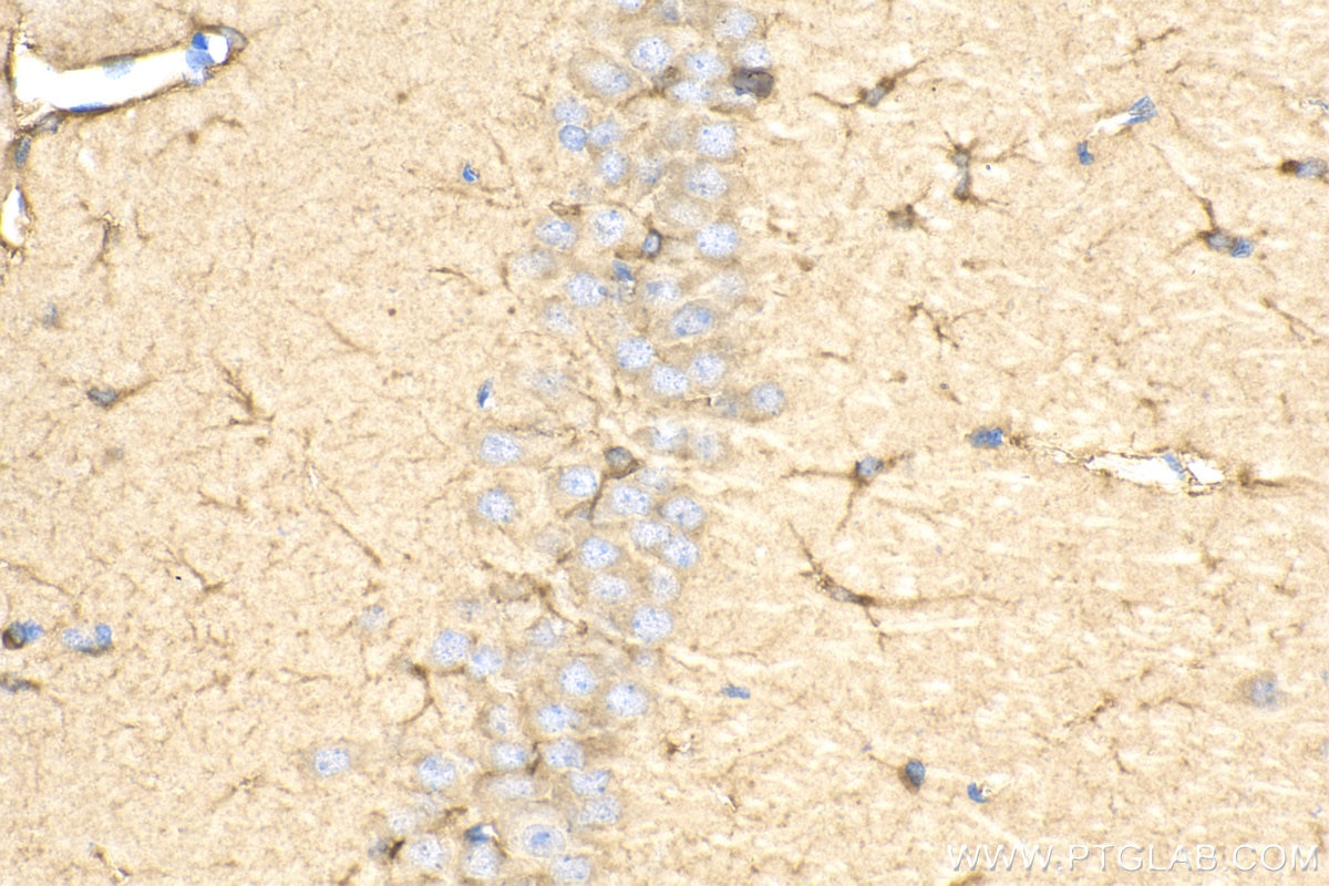 Immunohistochemistry (IHC) staining of rat brain tissue using GPAM Polyclonal antibody (12454-1-AP)