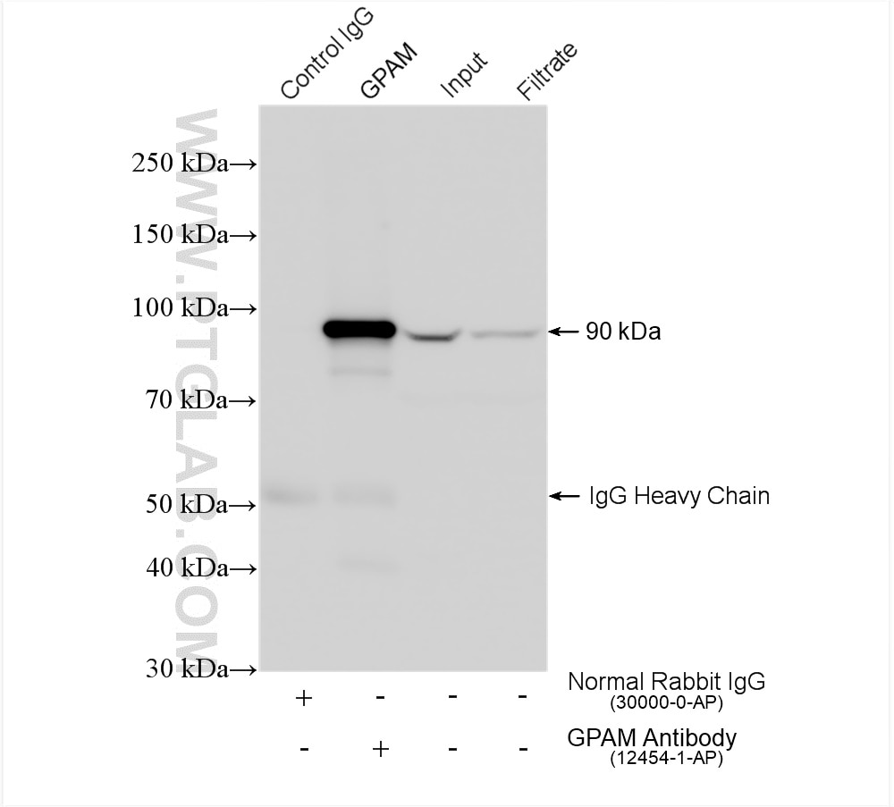 Immunoprecipitation (IP) experiment of mouse liver tissue using GPAM Polyclonal antibody (12454-1-AP)