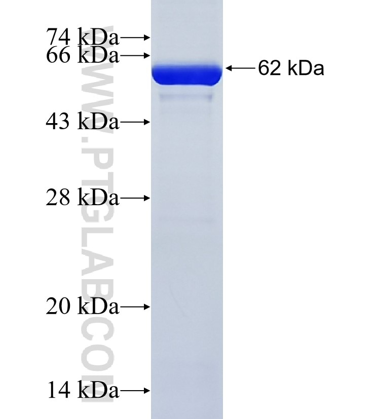 GPAM fusion protein Ag3120 SDS-PAGE