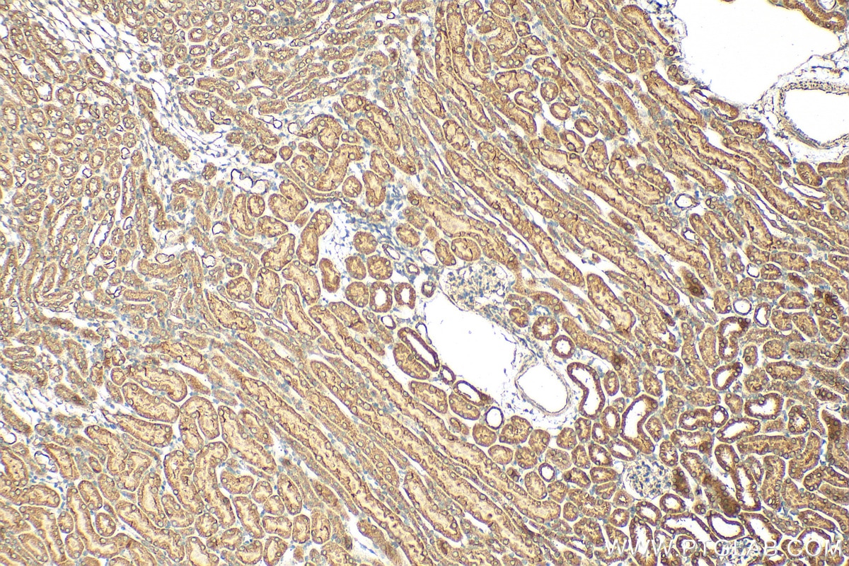 IHC staining of mouse kidney using 30765-1-AP