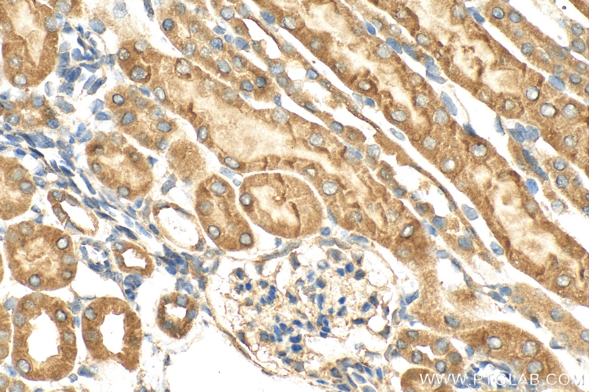 IHC staining of mouse kidney using 30765-1-AP