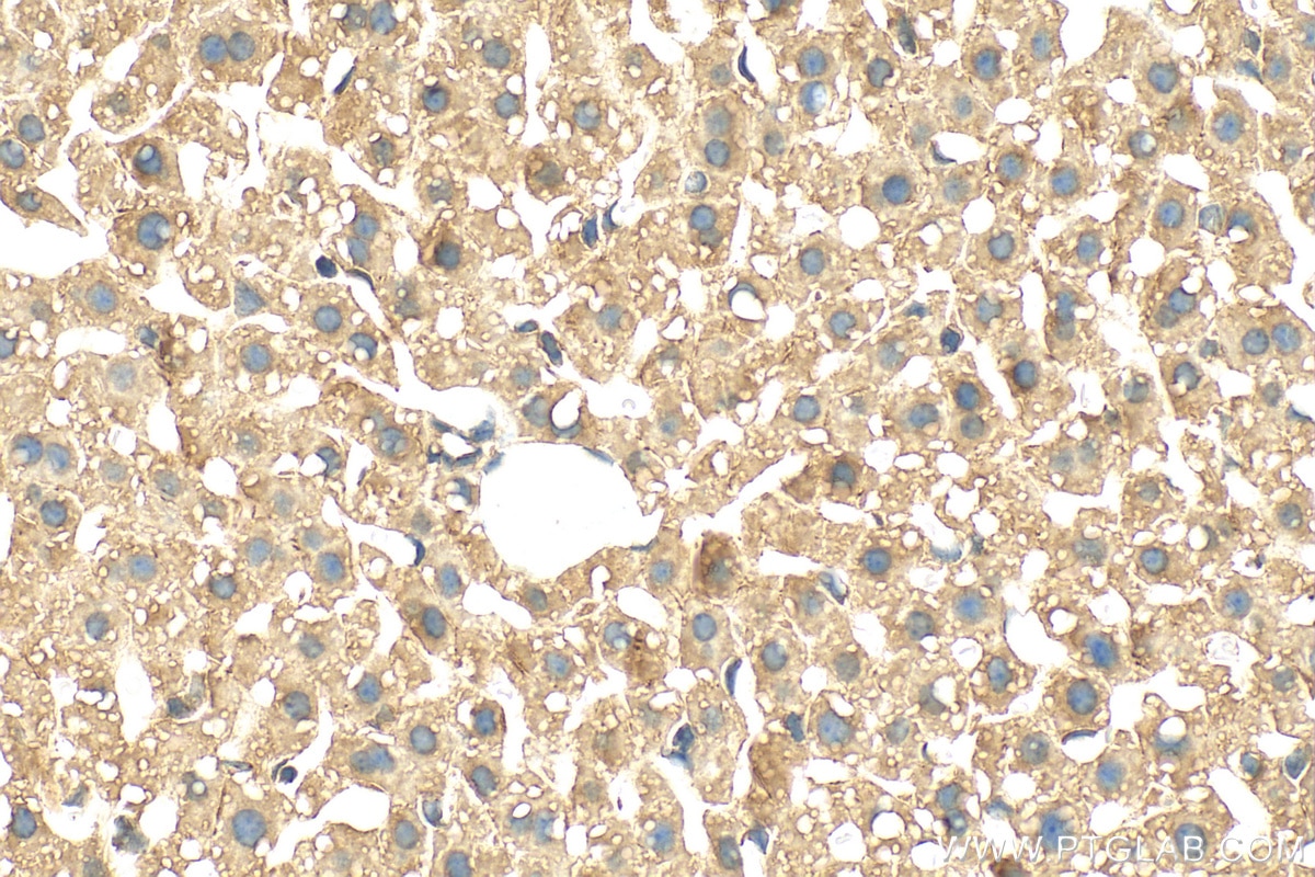 IHC staining of mouse liver using 30765-1-AP