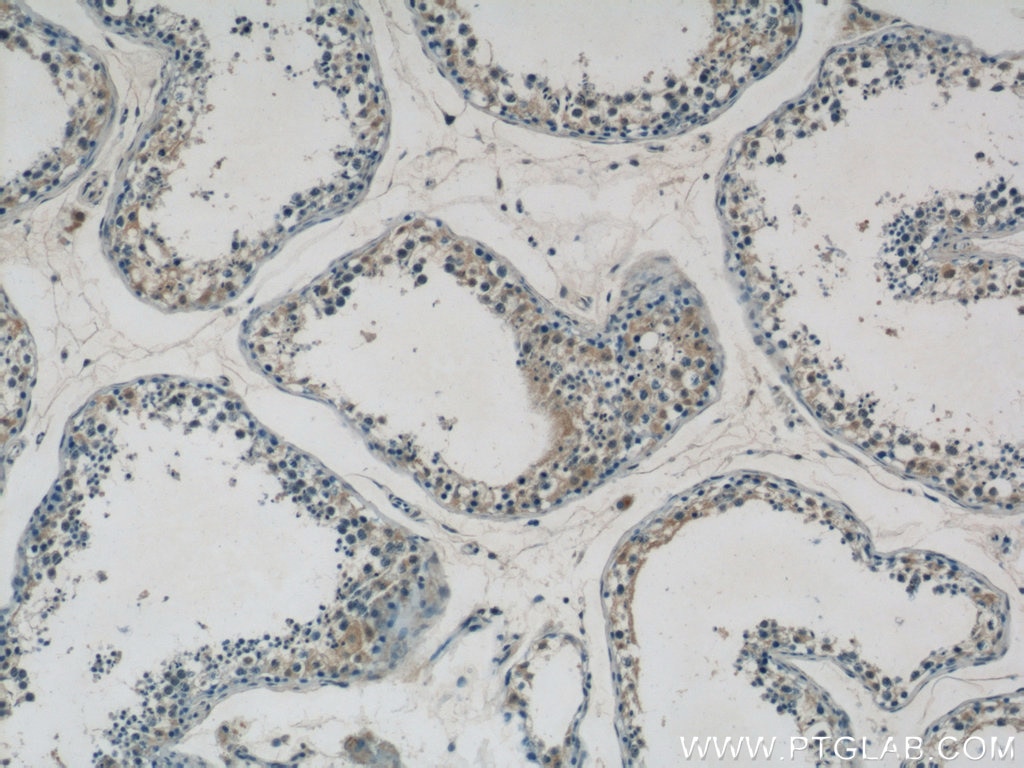 Immunohistochemistry (IHC) staining of human testis tissue using GPATCH2 Polyclonal antibody (24366-1-AP)