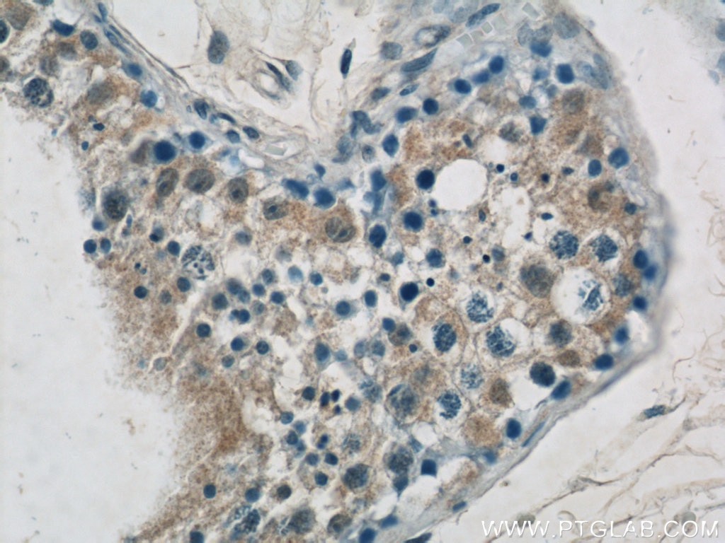 Immunohistochemistry (IHC) staining of human testis tissue using GPATCH2 Polyclonal antibody (24366-1-AP)