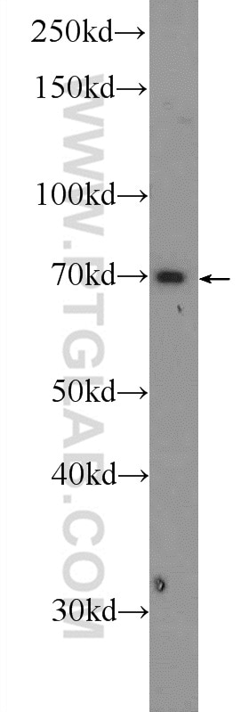 Western Blot (WB) analysis of mouse kidney tissue using GPATCH2 Polyclonal antibody (24366-1-AP)