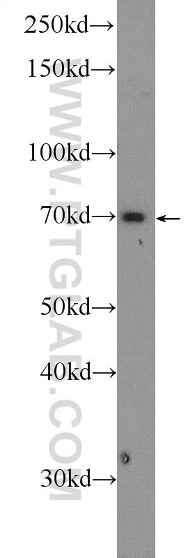 WB analysis of mouse kidney using 24366-1-AP