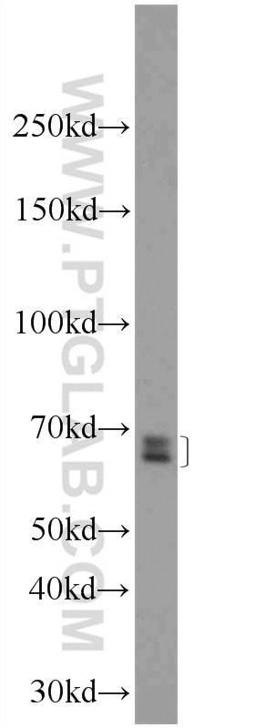 Western Blot (WB) analysis of mouse spleen tissue using GPATCH2 Polyclonal antibody (24366-1-AP)