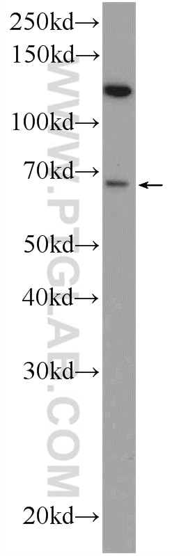 Western Blot (WB) analysis of mouse thymus tissue using GPATCH2 Polyclonal antibody (24366-1-AP)