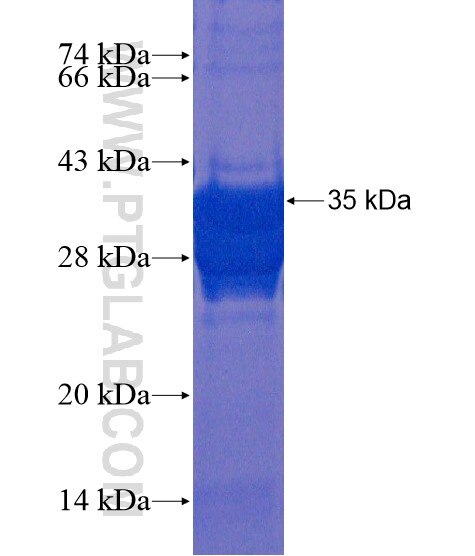 GPATCH2 fusion protein Ag21647 SDS-PAGE