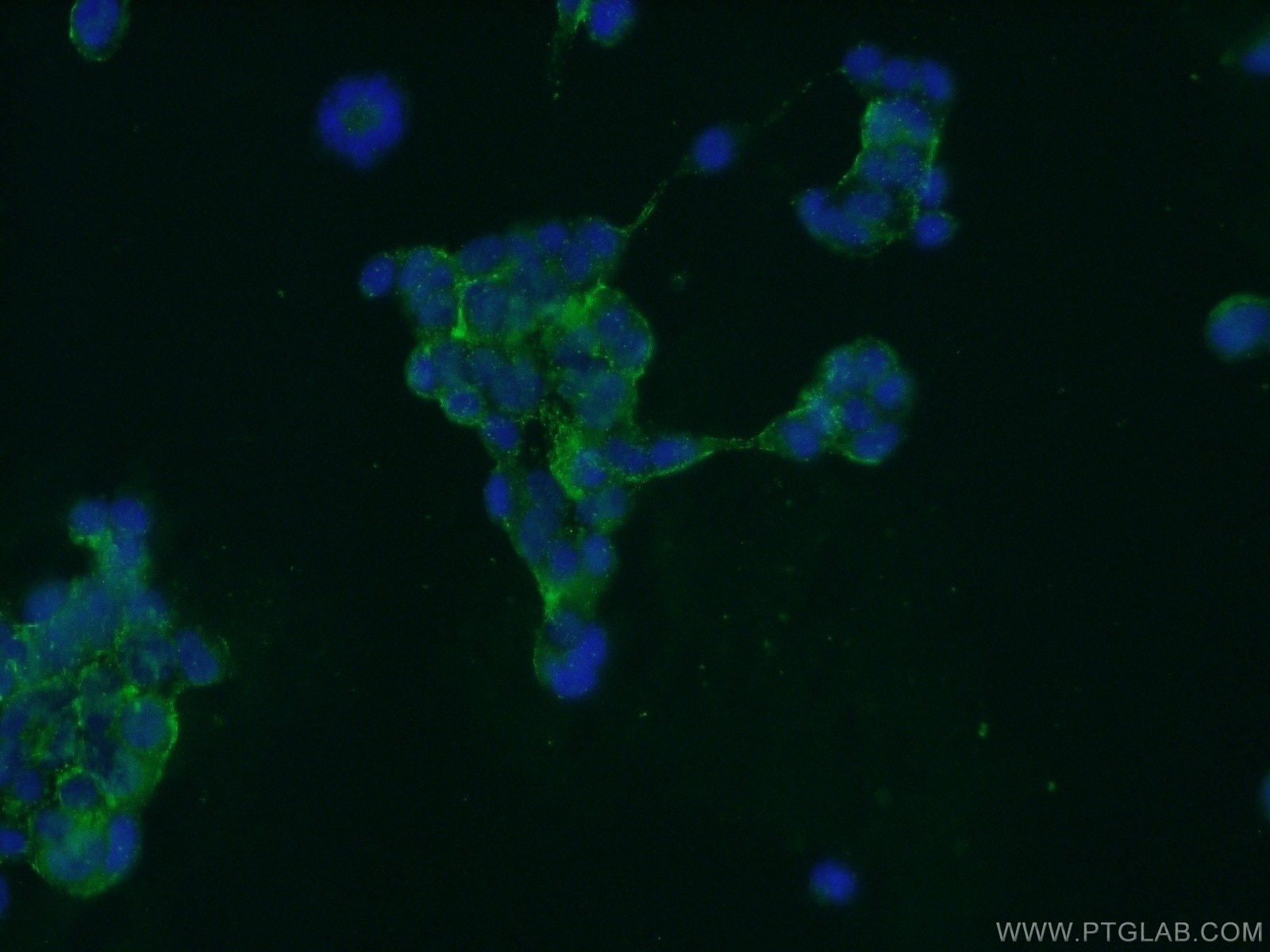 Immunofluorescence (IF) / fluorescent staining of HEK-293 cells using GPATCH4 Polyclonal antibody (24399-1-AP)
