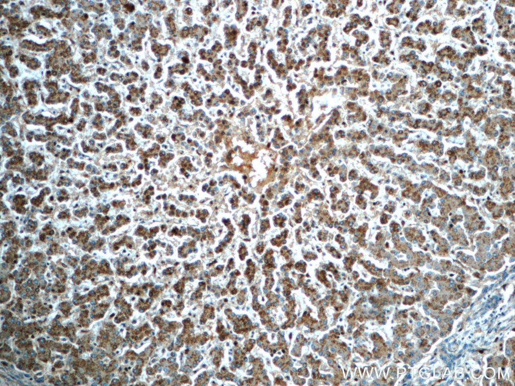 Immunohistochemistry (IHC) staining of human liver tissue using GPATCH4 Polyclonal antibody (24399-1-AP)