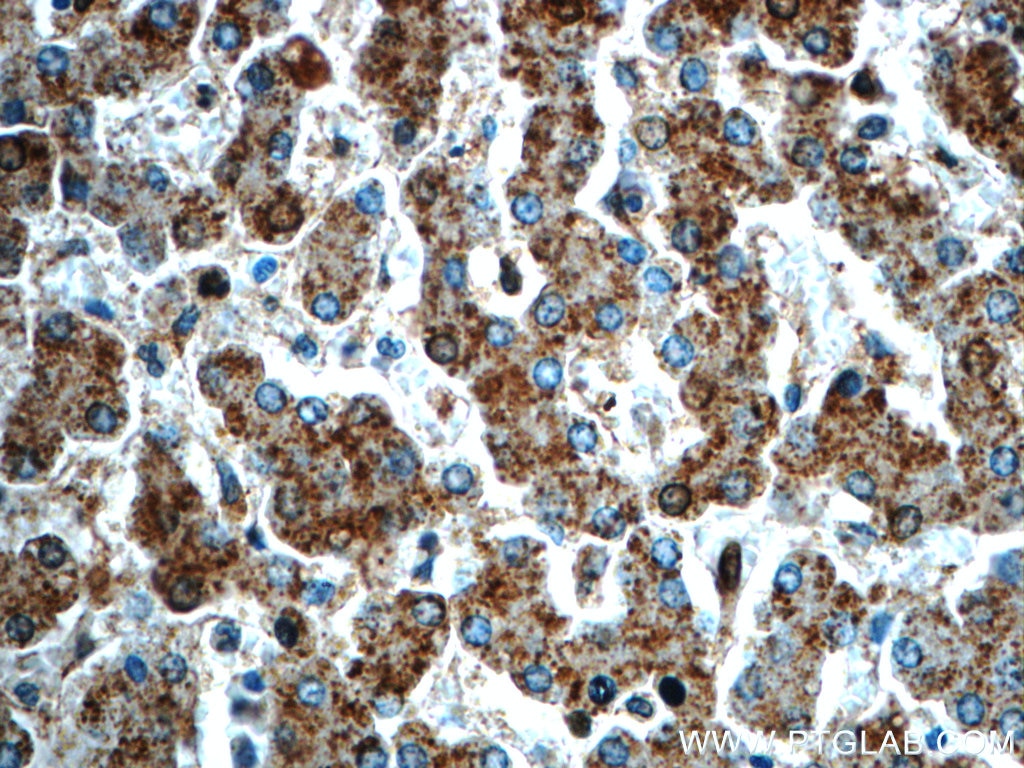 Immunohistochemistry (IHC) staining of human liver tissue using GPATCH4 Polyclonal antibody (24399-1-AP)