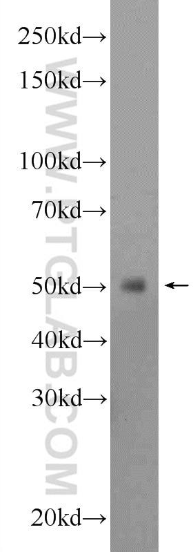 Western Blot (WB) analysis of HEK-293 cells using GPATCH4 Polyclonal antibody (24399-1-AP)