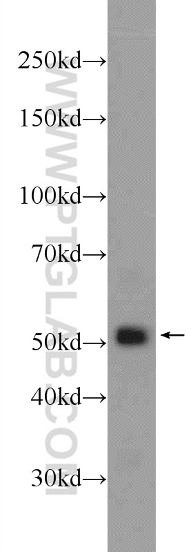 Western Blot (WB) analysis of HEK-293 cells using GPATCH4 Polyclonal antibody (24399-1-AP)