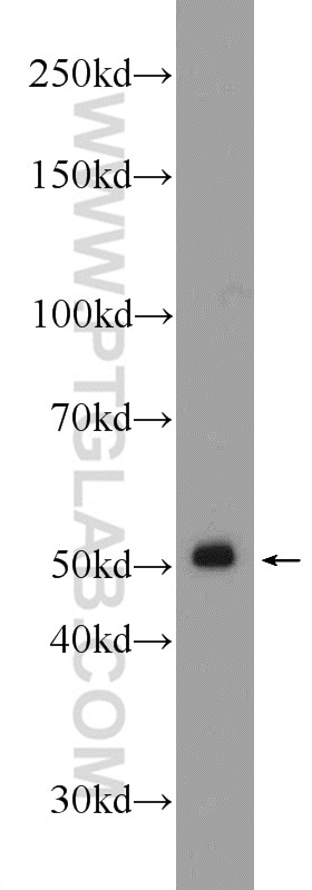 Western Blot (WB) analysis of mouse kidney tissue using GPATCH4 Polyclonal antibody (24399-1-AP)