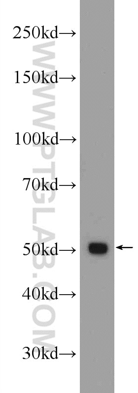 Western Blot (WB) analysis of rat kidney tissue using GPATCH4 Polyclonal antibody (24399-1-AP)