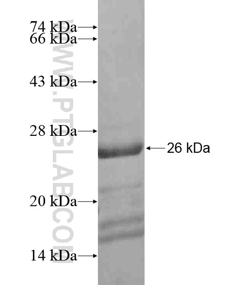 GPATCH4 fusion protein Ag20285 SDS-PAGE