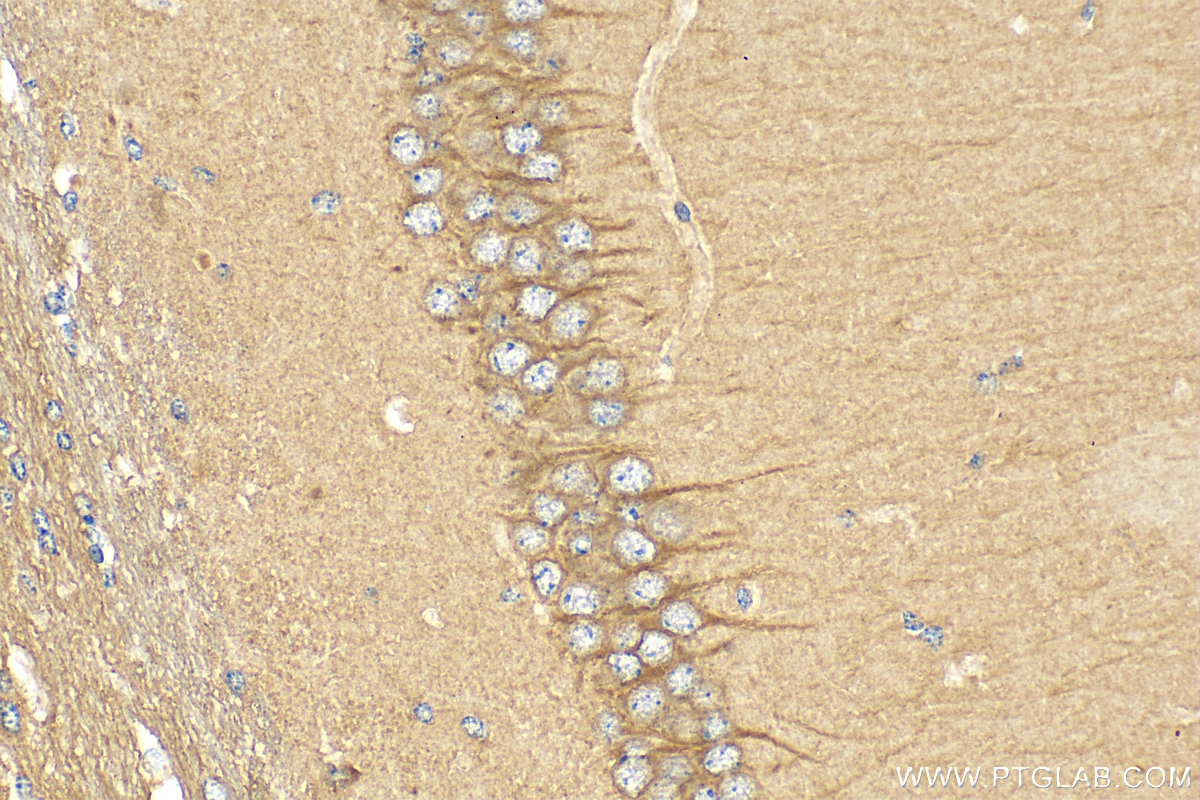 Immunohistochemistry (IHC) staining of mouse brain tissue using GPBAR1 Polyclonal antibody (26739-1-AP)