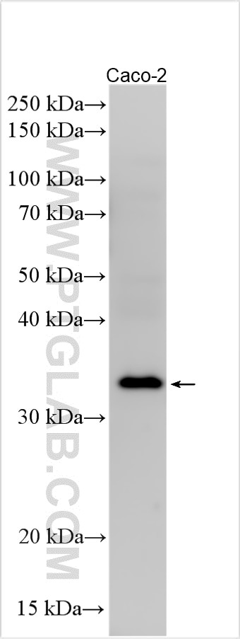 Western Blot (WB) analysis of various lysates using GPBAR1 Polyclonal antibody (26739-1-AP)
