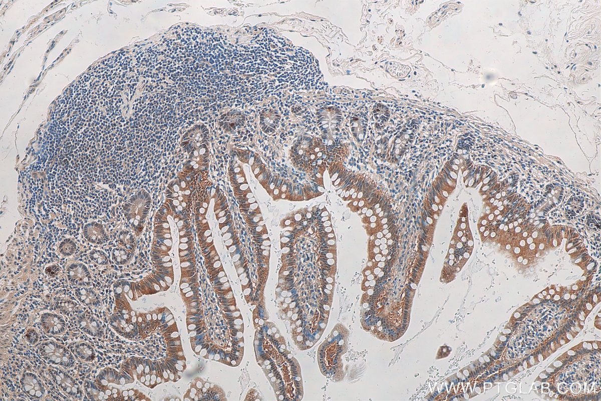 IHC staining of human small intestine using 21622-1-AP