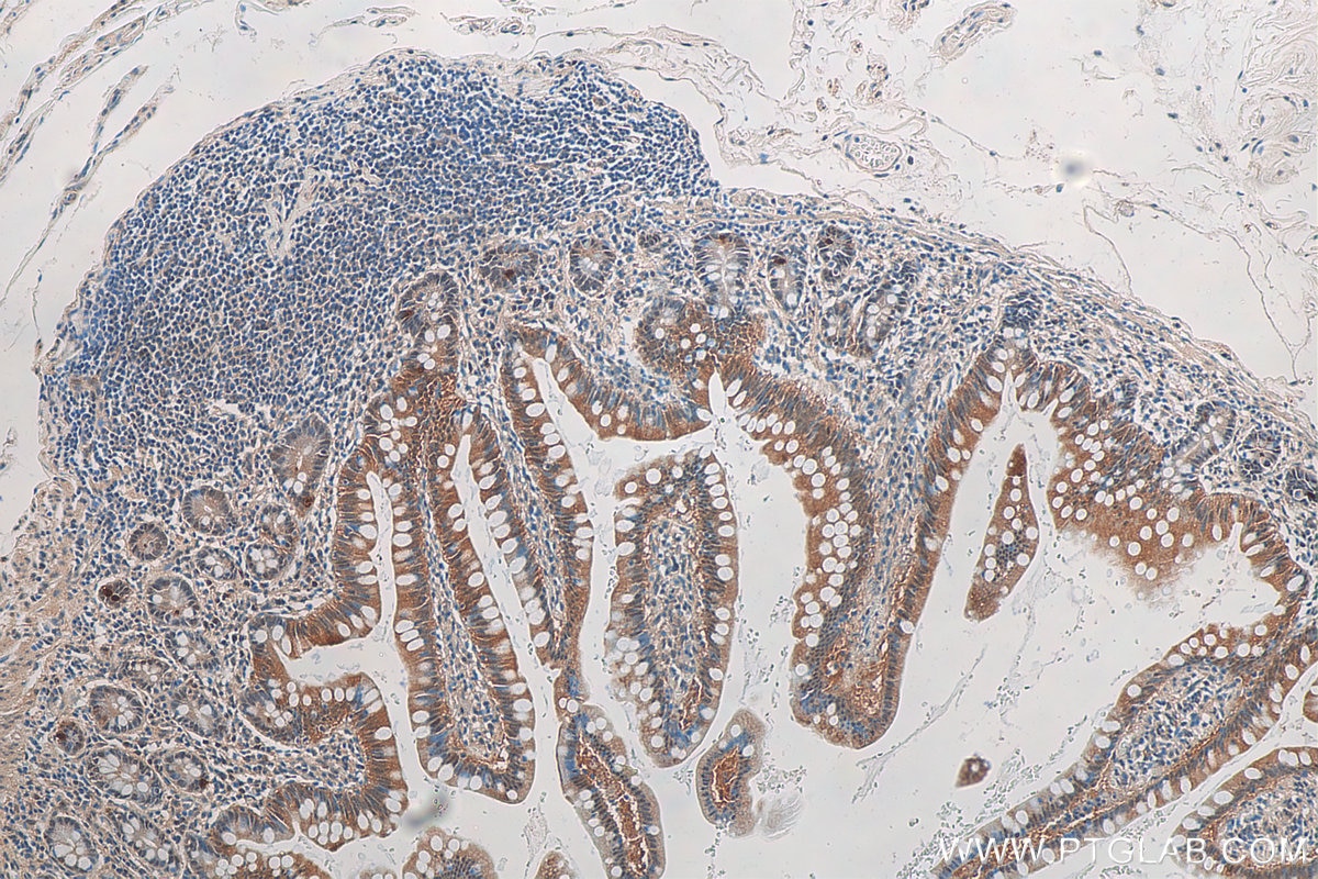 Immunohistochemistry (IHC) staining of human small intestine tissue using GPBP1 Polyclonal antibody (21622-1-AP)