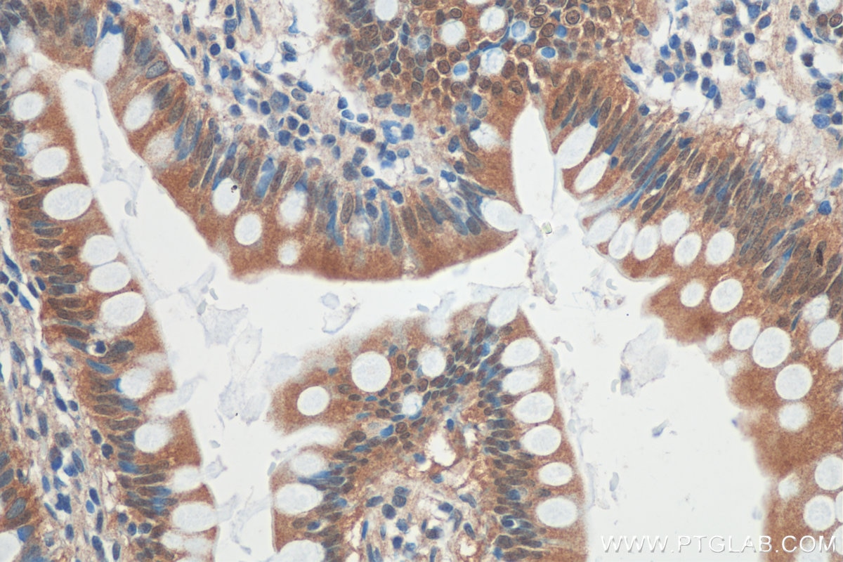 Immunohistochemistry (IHC) staining of human small intestine tissue using GPBP1 Polyclonal antibody (21622-1-AP)