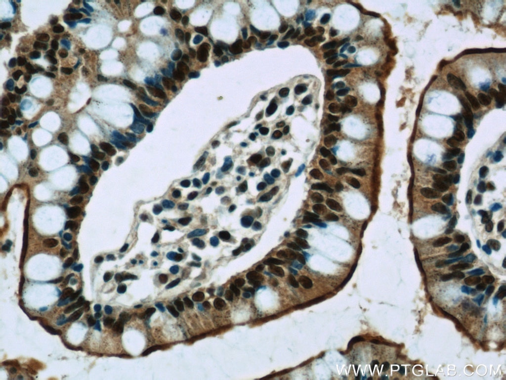 Immunohistochemistry (IHC) staining of human small intestine tissue using GPBP1 Polyclonal antibody (21622-1-AP)