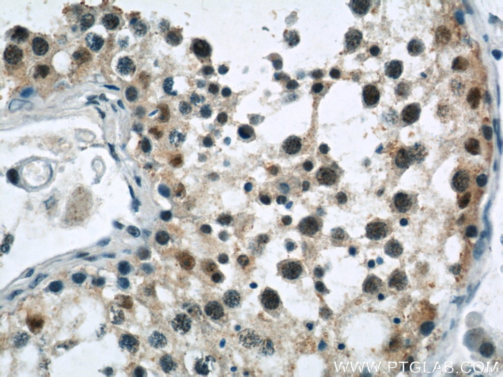 Immunohistochemistry (IHC) staining of human testis tissue using GPBP1 Polyclonal antibody (21622-1-AP)