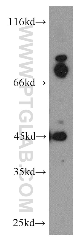 Western Blot (WB) analysis of HepG2 cells using GPBP1 Polyclonal antibody (21622-1-AP)