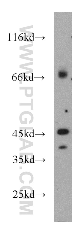 Western Blot (WB) analysis of L02 cells using GPBP1 Polyclonal antibody (21622-1-AP)