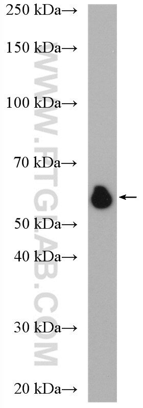 Western Blot (WB) analysis of Jurkat cells using GPBP1L1 Polyclonal antibody (17375-1-AP)