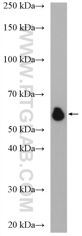 WB analysis of Jurkat using 17375-1-AP