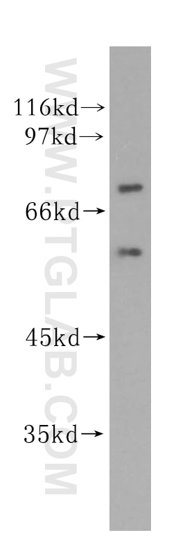 Western Blot (WB) analysis of HepG2 cells using GPBP1L1 Polyclonal antibody (17375-1-AP)