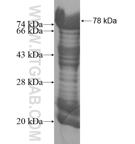 GPBP1L1 fusion protein Ag11180 SDS-PAGE
