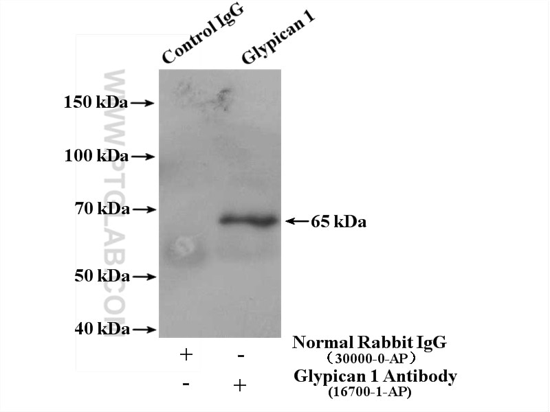 Immunoprecipitation (IP) experiment of BxPC-3 cells using Glypican 1 Polyclonal antibody (16700-1-AP)