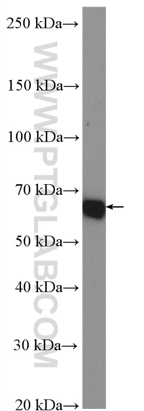 Western Blot (WB) analysis of HepG2 cells using Glypican 1 Polyclonal antibody (16700-1-AP)