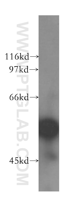 Glypican 1 Polyclonal antibody